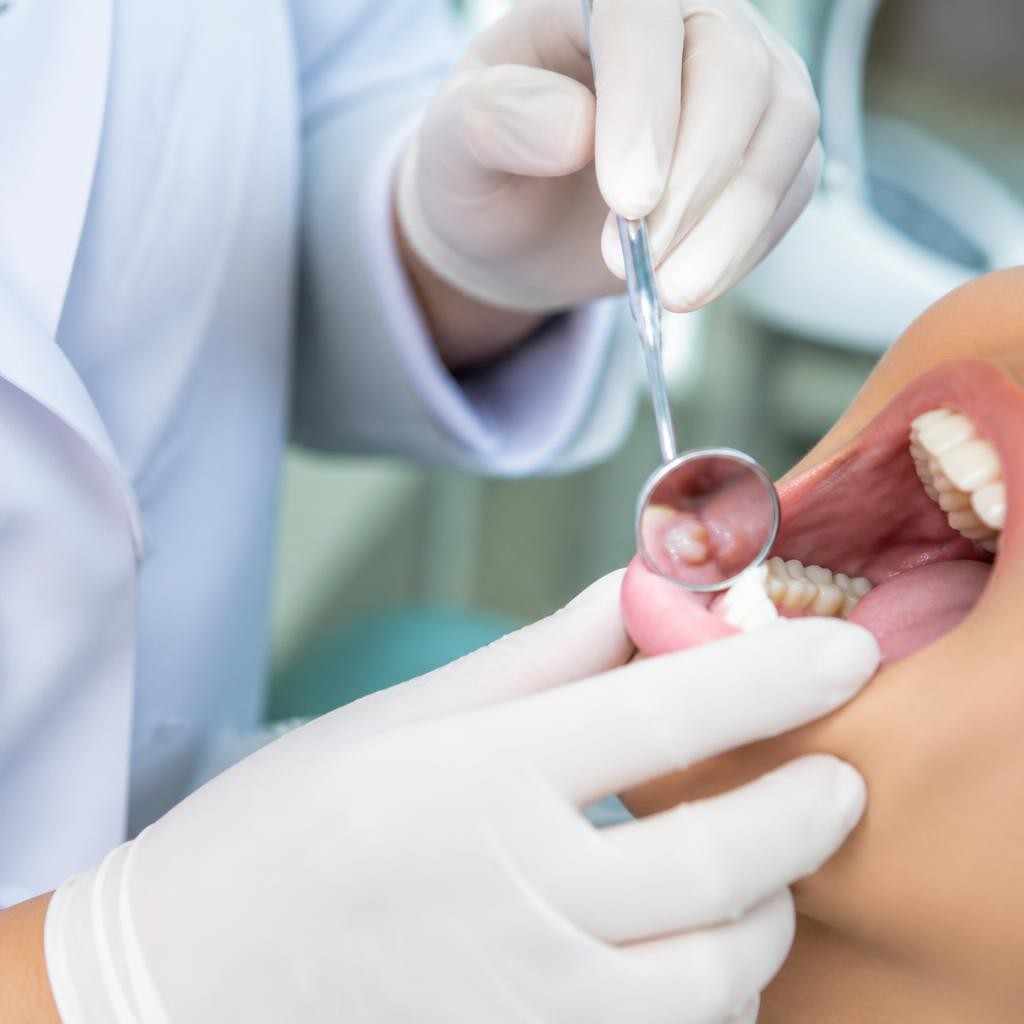 Dentista Especialista em Estomatologia: quando consultar por bolinha na boca
