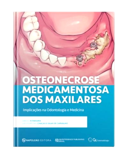 Osteonecrose Medicamentosa dos maxilares